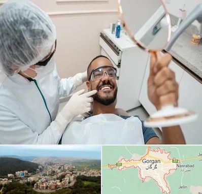 ایمپلنت فوری در گرگان