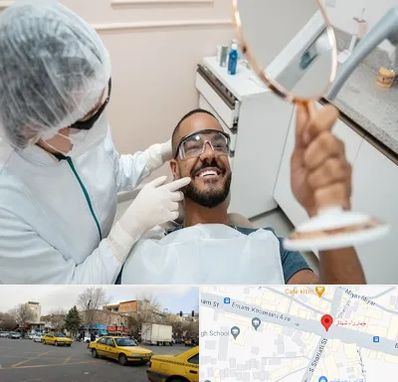 ایمپلنت فوری در شهناز تبریز