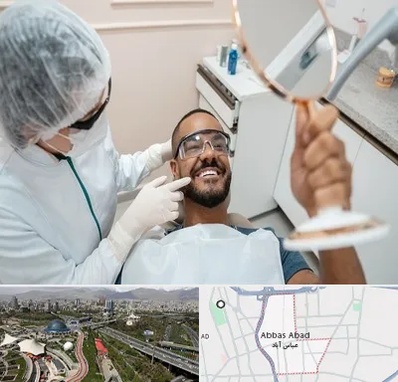 ایمپلنت فوری در عباس آباد تهران