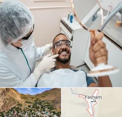 ایمپلنت فوری در فشم