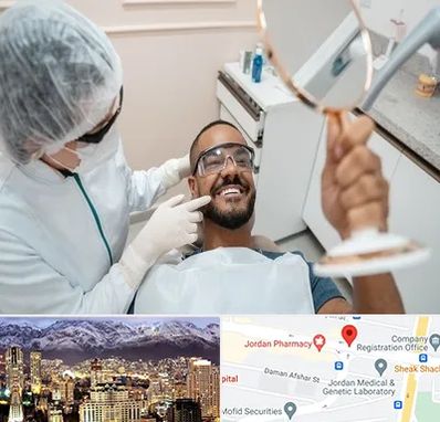 ایمپلنت فوری در جردن 