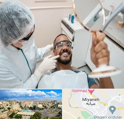 ایمپلنت فوری در میانه