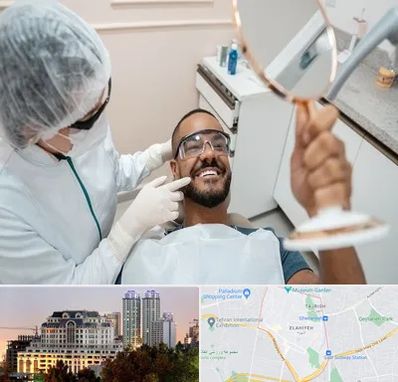 ایمپلنت فوری در فرشته 