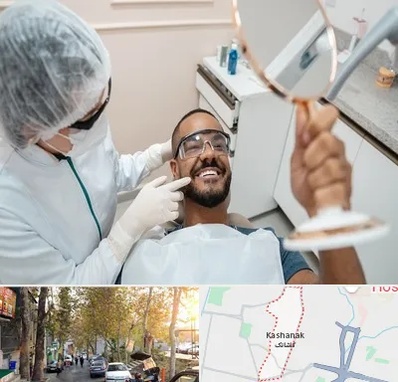 ایمپلنت فوری در کاشانک