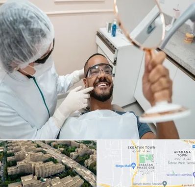 ایمپلنت فوری در اکباتان 