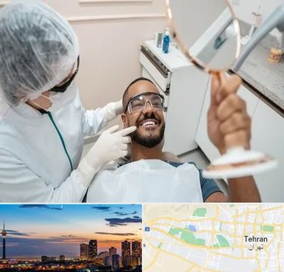 ایمپلنت فوری در غرب تهران 