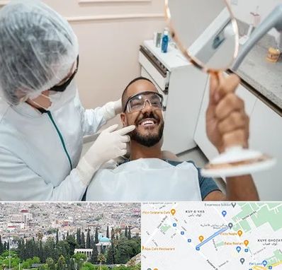 ایمپلنت فوری در محلاتی شیراز