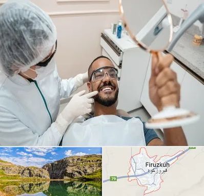 ایمپلنت فوری در فیروزکوه