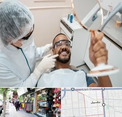ایمپلنت فوری در سلسبیل
