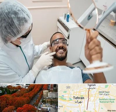 ایمپلنت فوری در ولیعصر 