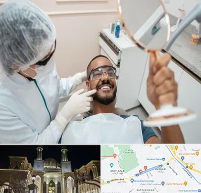 ایمپلنت فوری در زرگری شیراز