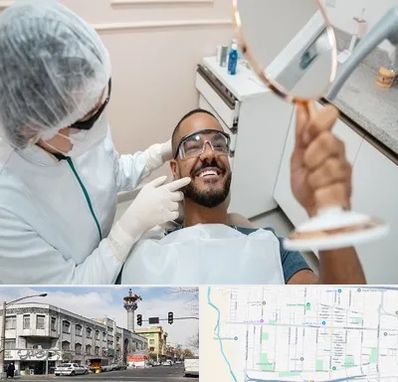 ایمپلنت فوری در 17شهریور