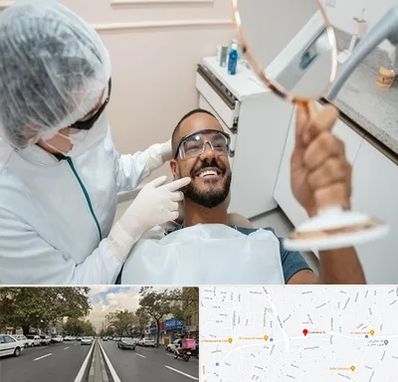 ایمپلنت فوری در دولت