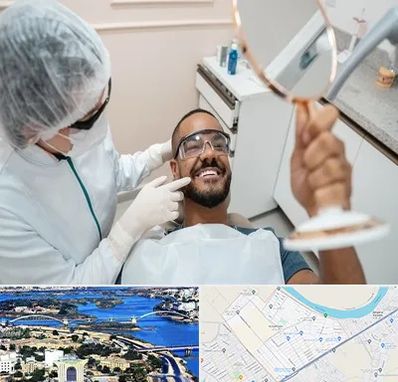 ایمپلنت فوری در کوروش اهواز