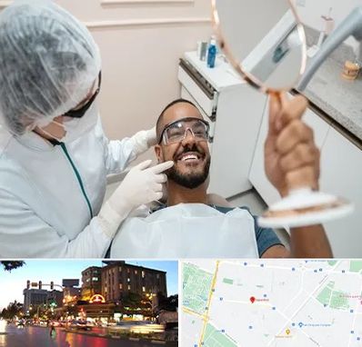 ایمپلنت فوری در بلوار سجاد مشهد