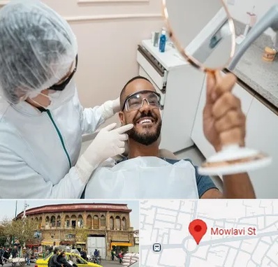 ایمپلنت فوری در مولوی