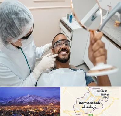 ایمپلنت فوری در کرمانشاه