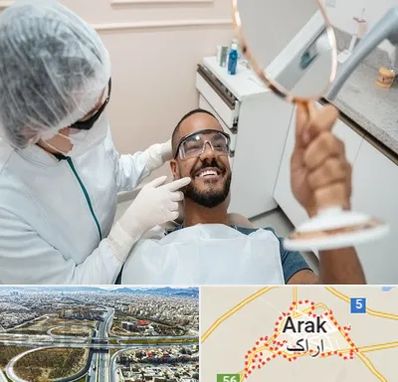 ایمپلنت فوری در اراک