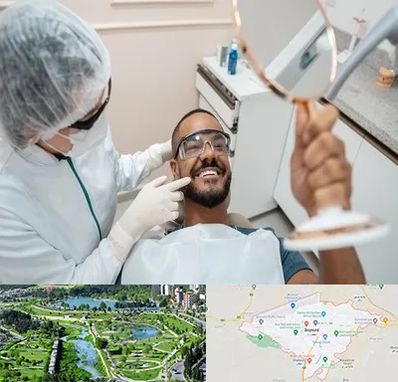 ایمپلنت فوری در بجنورد