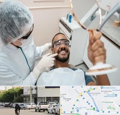 ایمپلنت فوری در قدوسی شرقی شیراز