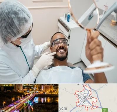 ایمپلنت فوری در سقز