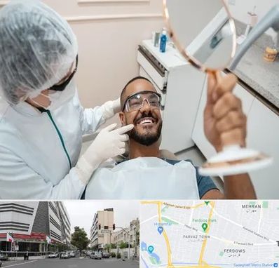 ایمپلنت فوری در بلوار فردوس 