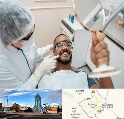 ایمپلنت فوری در تایباد