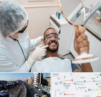 ایمپلنت فوری در پیروزی 