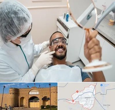 ایمپلنت فوری در ایرانشهر