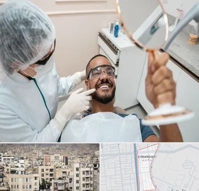 ایمپلنت فوری در اسکندری