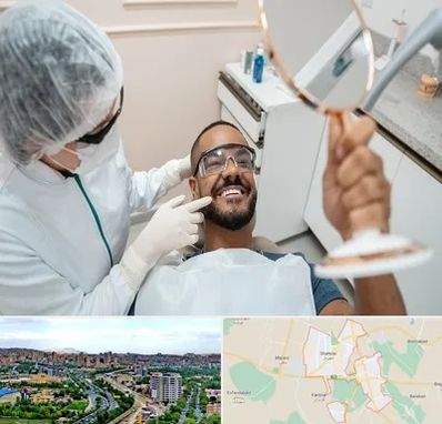 ایمپلنت فوری در شهریار