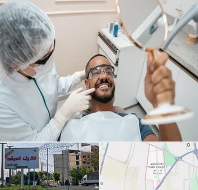 ایمپلنت فوری در فاز یک اندیشه