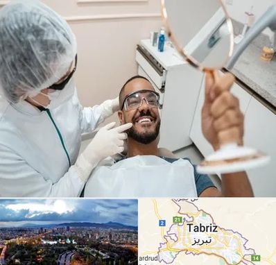 ایمپلنت فوری در تبریز