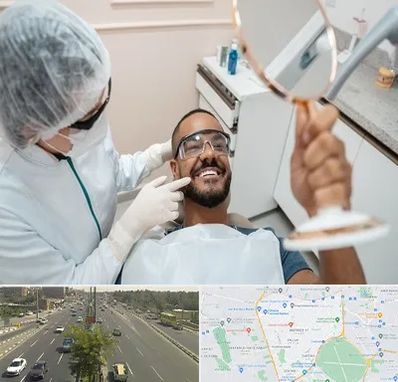 ایمپلنت فوری در منطقه 17 تهران