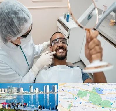 ایمپلنت فوری در چیتگر 