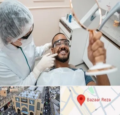 ایمپلنت فوری در بازار رضا مشهد