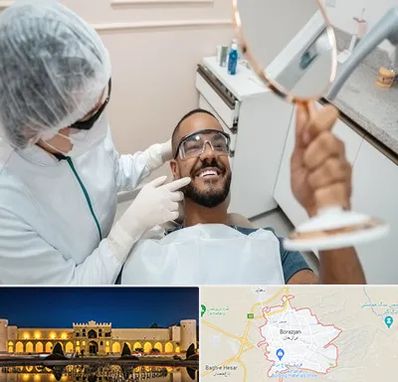 ایمپلنت فوری در برازجان