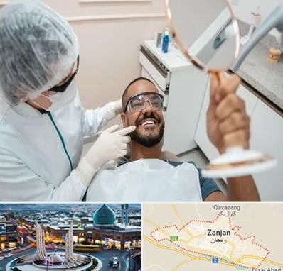 ایمپلنت فوری در زنجان