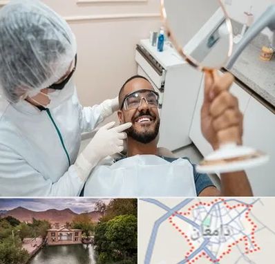 ایمپلنت فوری در دامغان