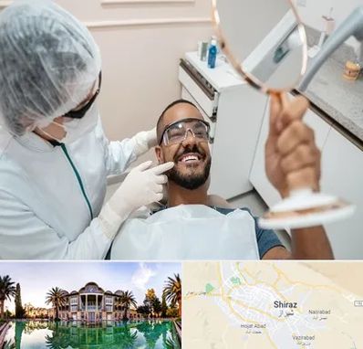 ایمپلنت فوری در شیراز