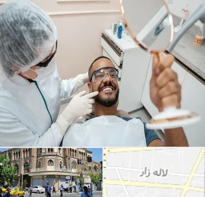 ایمپلنت فوری در لاله زار