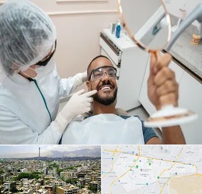 ایمپلنت فوری در منطقه 8 تهران