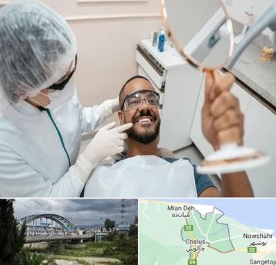 ایمپلنت فوری در چالوس