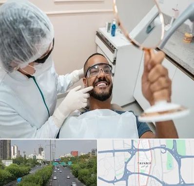 ایمپلنت فوری در توانیر