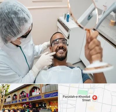 ایمپلنت فوری در 15 خرداد