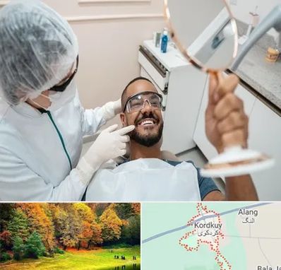 ایمپلنت فوری در کردکوی