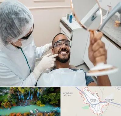 ایمپلنت فوری در دورود