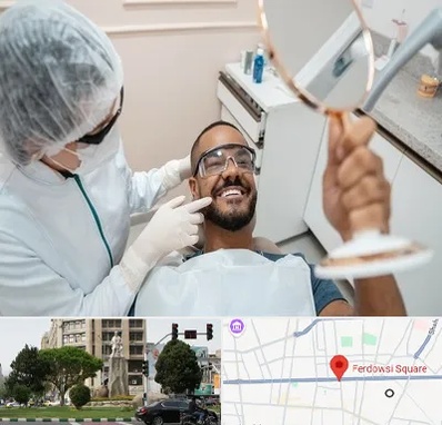 ایمپلنت فوری در میدان فردوسی تهران