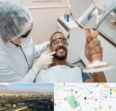 ایمپلنت فوری در هنگام