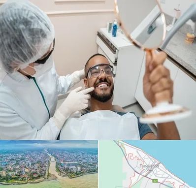 ایمپلنت فوری در تنکابن